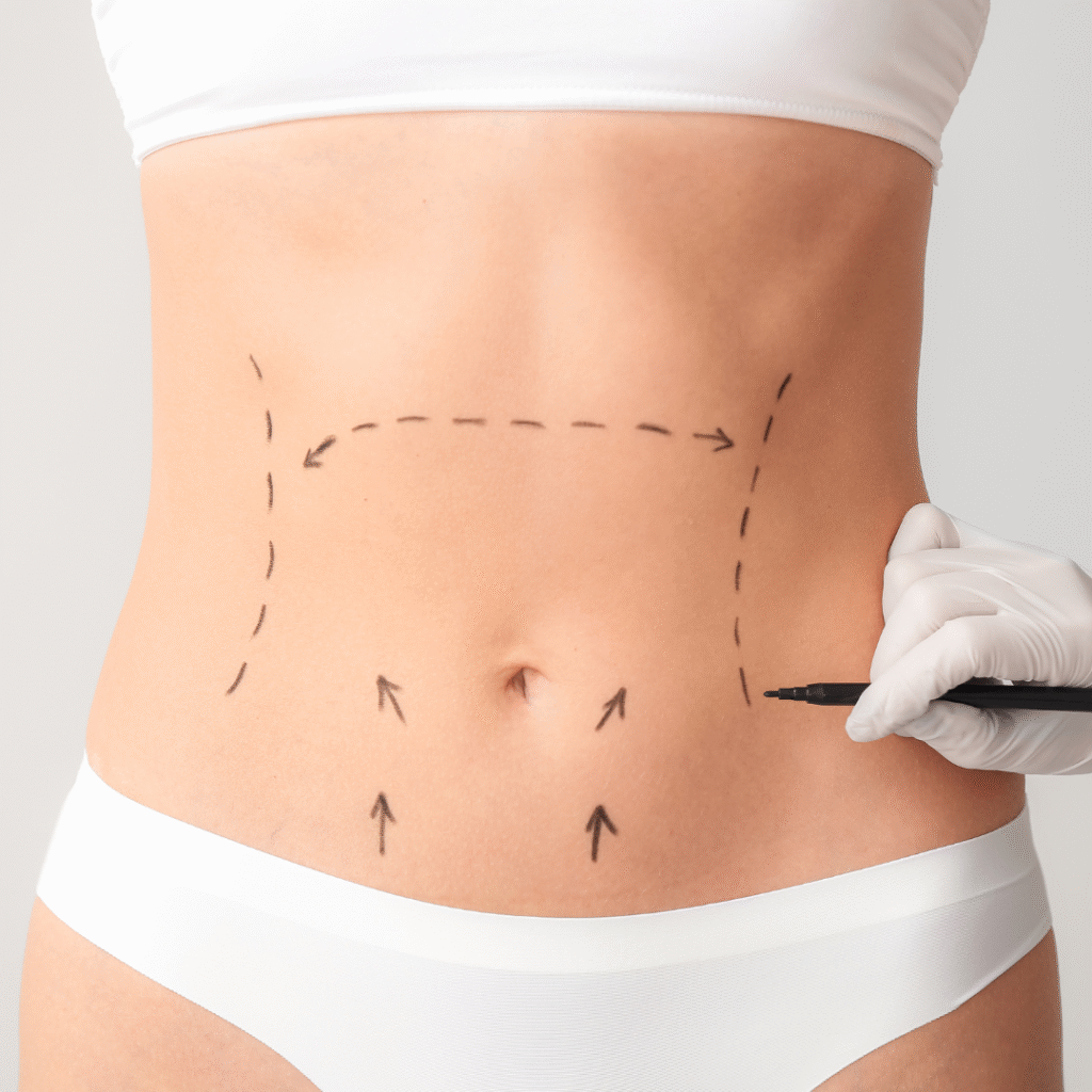 Plastic Surgery in Antalya. Tummy Tuck Antalya & Mummy Makeover Turkey