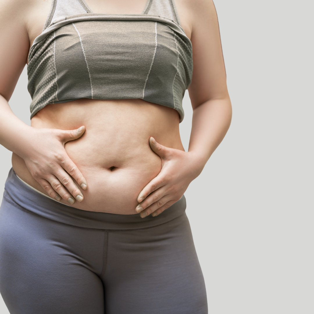Woman showing post pregnancy abdominal changes with loose skin and lower belly after childbirth