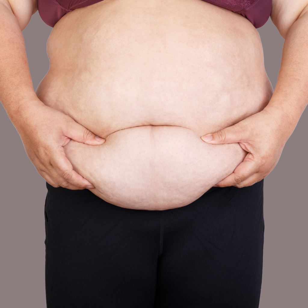 Woman experiencing loose abdominal skin after pregnancy despite diet and exercise