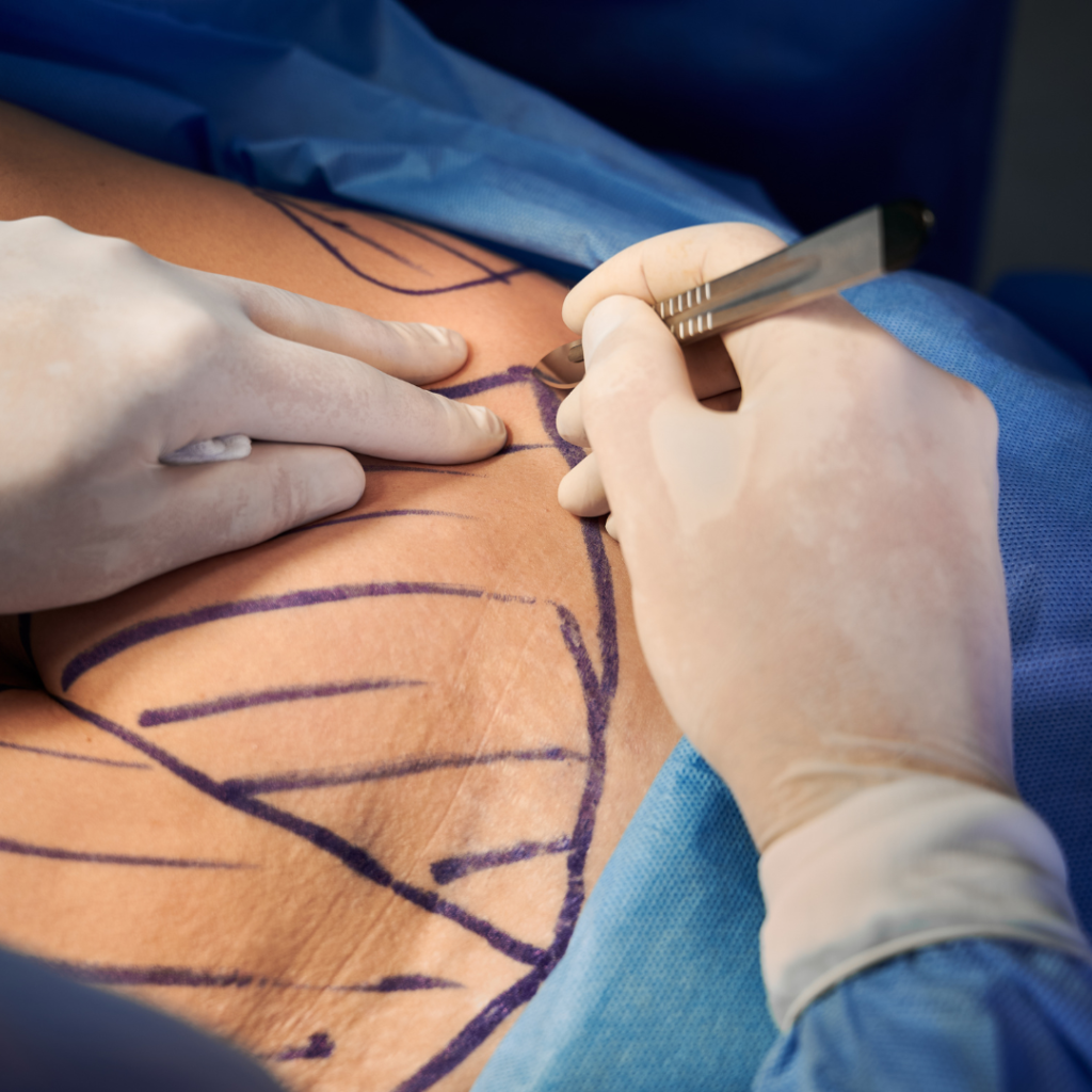 plastic surgery Turkey UK patient consultation in Antalya hospital