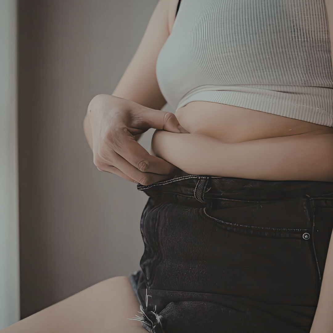 Woman after pregnancy during medical assessment to determine suitability for a mummy makeover procedure