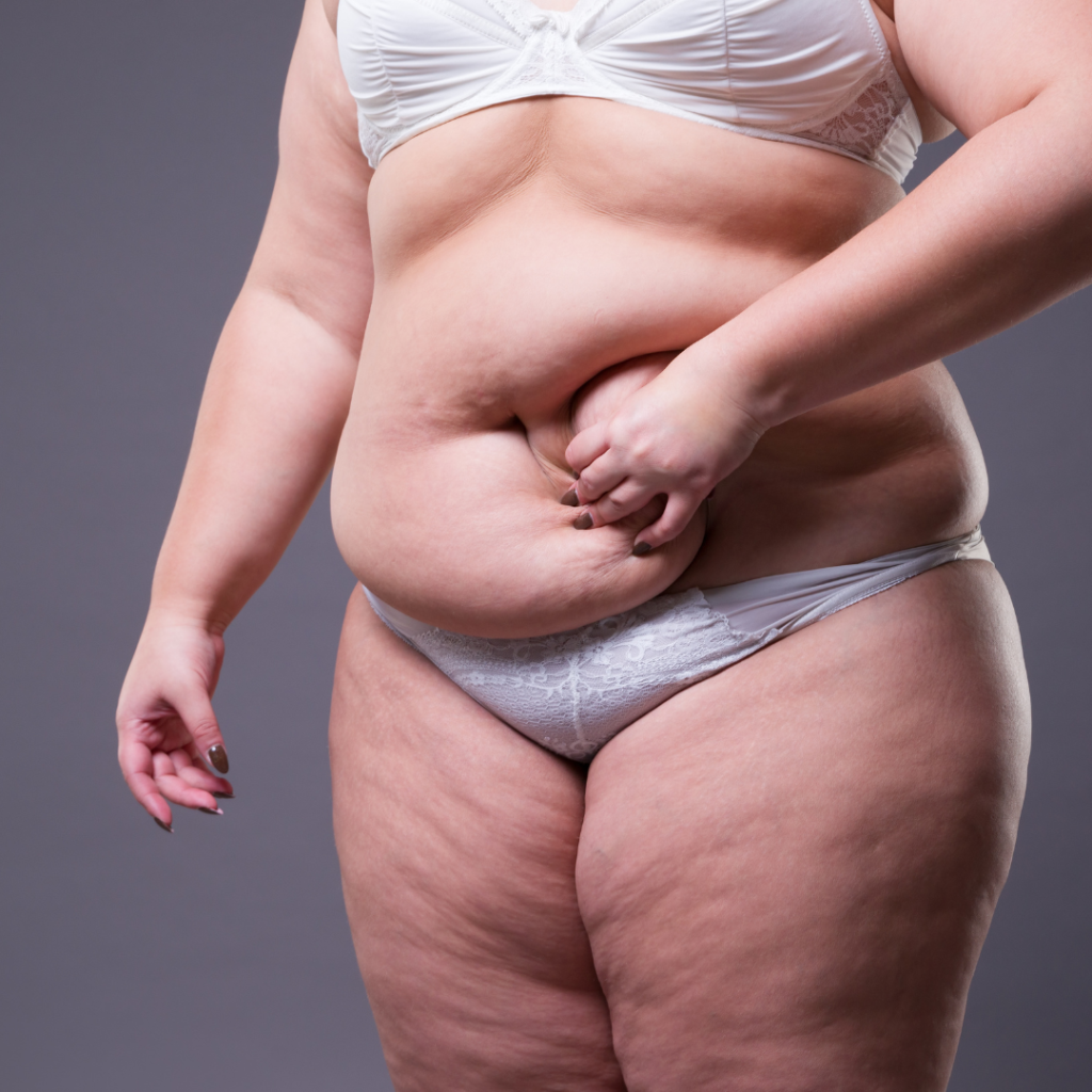 Woman researching mummy makeover surgery and exploring how to avoid common mistakes before treatment