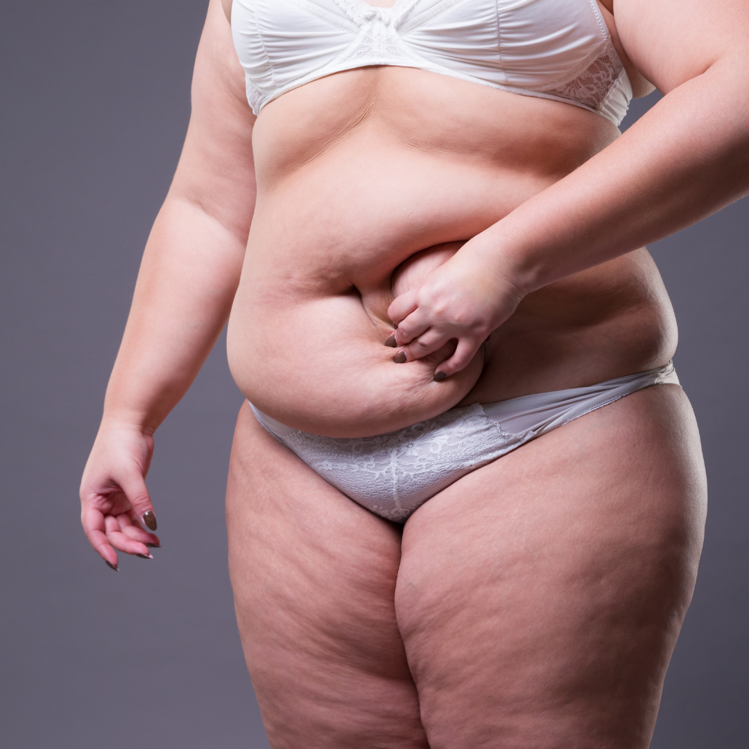 Woman researching mummy makeover surgery and exploring how to avoid common mistakes before treatment
