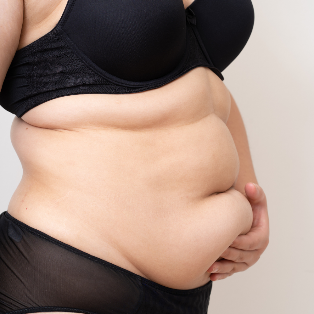 Comparison between tummy tuck and mummy makeover procedures after pregnancy