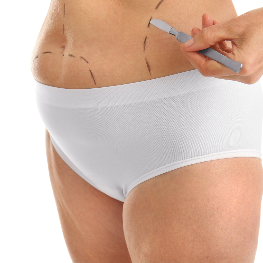 Liposuction Turkey body contouring treatment planning