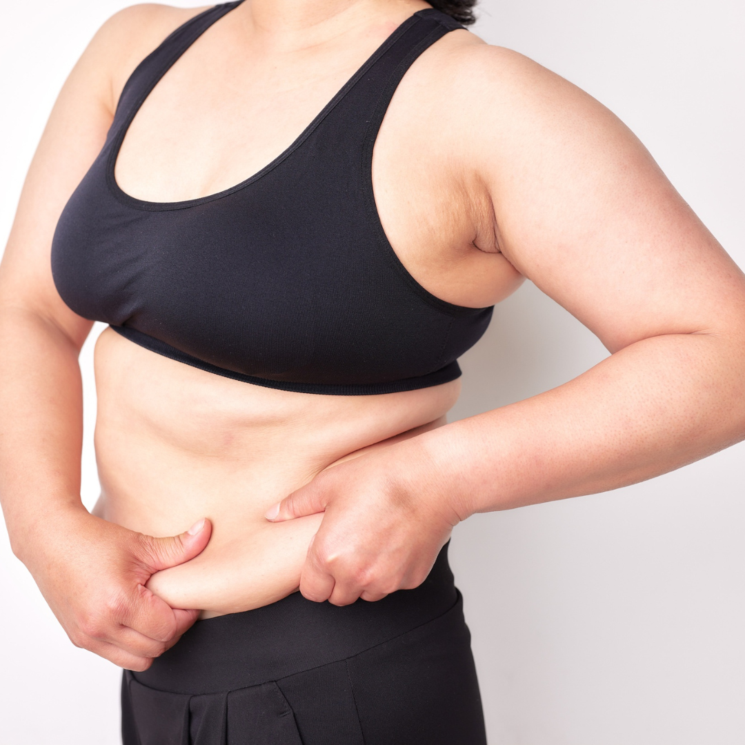 Woman with loose abdominal skin after pregnancy